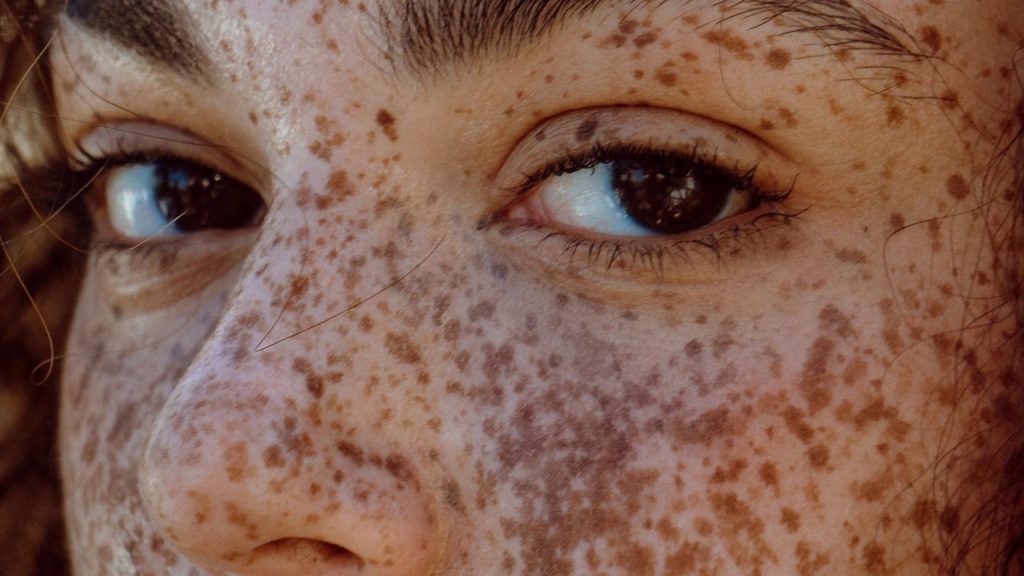 These Are the Best Radio Frequency Devices to Stimulate Collagen Production