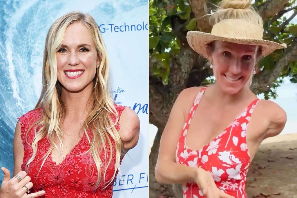 Bethany Hamilton Demonstrates ‘Simple’ One-Arm ‘Hack’ for Tying Her Hair Up