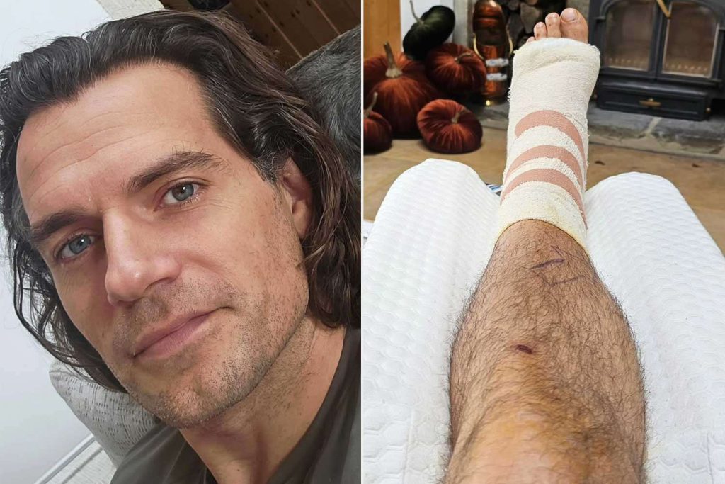 Henry Cavill Breaks Silence After Leg Injury in Training for 'Highlander'