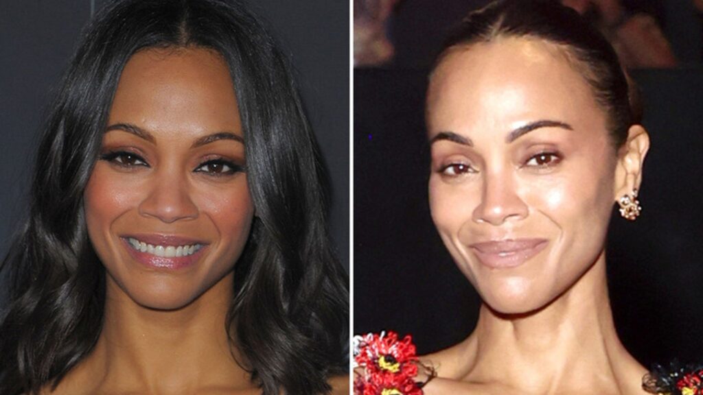 'Avatar' Queen Zoe Saldana Good Genes or Good Docs?!