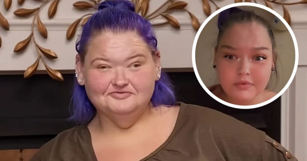 ‘1000-Lb Sisters’ Star Amy Slaton’s Successful Results of Lazy Eye Surgery Revealed – InTouch Weekly ‘1000-Lb Sisters’ Star Amy Slaton’s Successful Results of Lazy Eye Surgery Revealed - InTouch Weekly