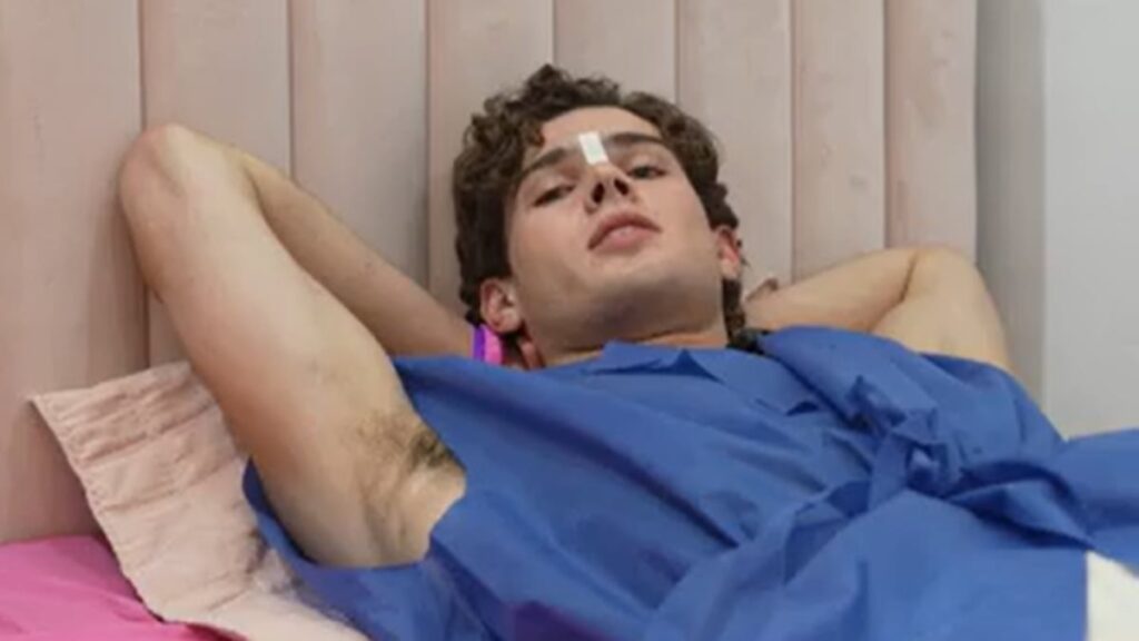 20-Year-Old Influencer Clavicular Livestreams Nose Job Surgery for Thousands of Viewers – Just Jared – Celebrity News and Gossip 20-Year-Old Influencer Clavicular Livestreams Nose Job Surgery for Thousands of Viewers - Just Jared - Celebrity News and Gossip